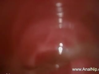 Extreme Mongolian Anal Hairy adult clip clip